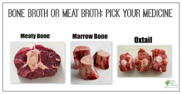 Bone Broth or Meat Broth: Pick Your Medicine