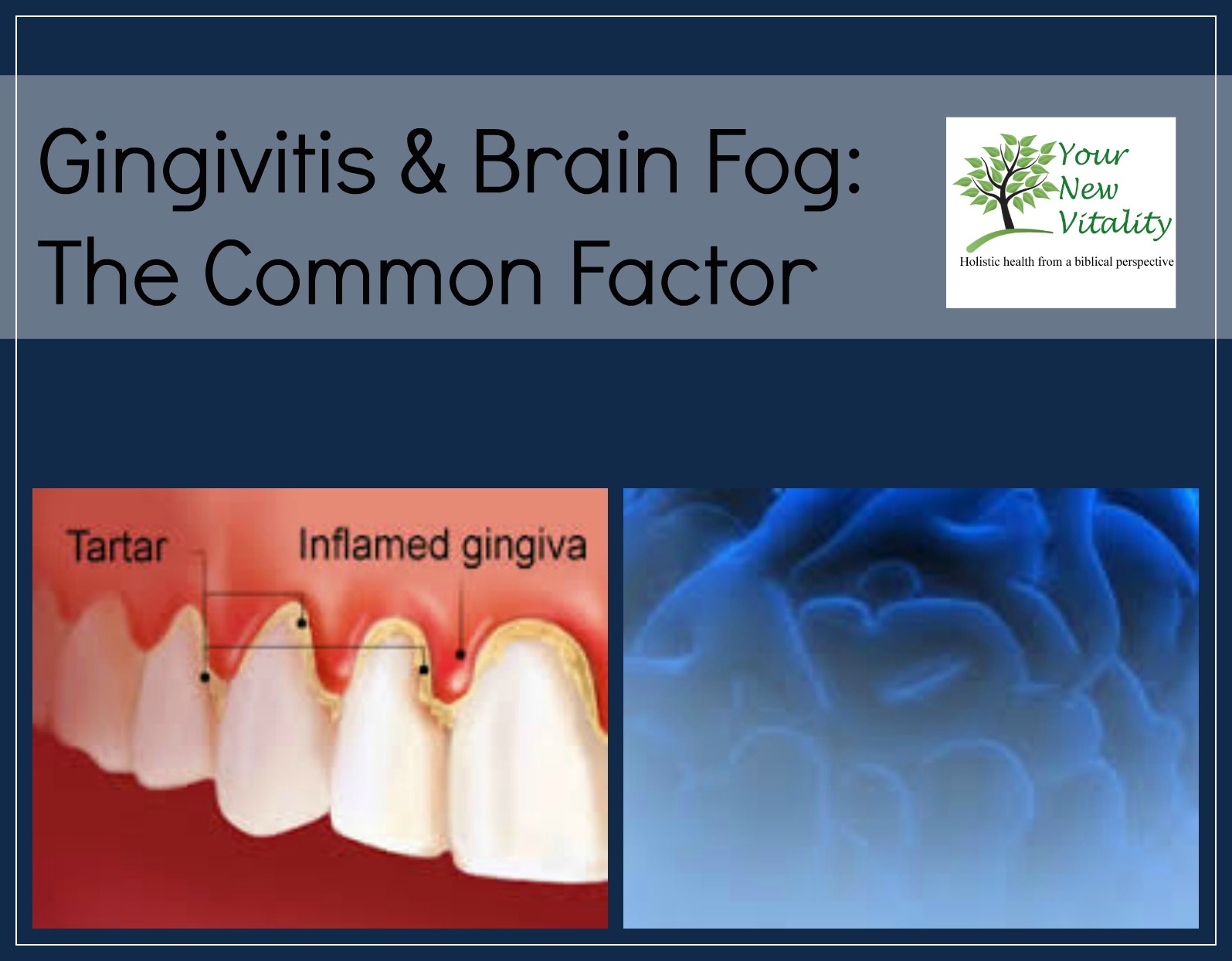 Gingivitis & Brain Fog: The Common Factor